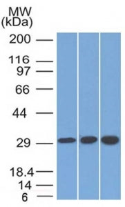 SDHB Antibody