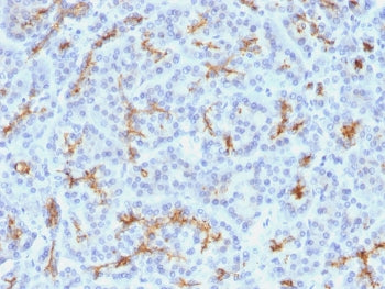 IHC testing of FFPE human pancreas with CFTR antibody (clone M3A7). Staining of FFPE tissue is enhan
