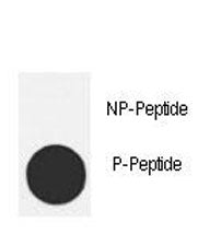 MDM2 Antibody (phospho-T218)