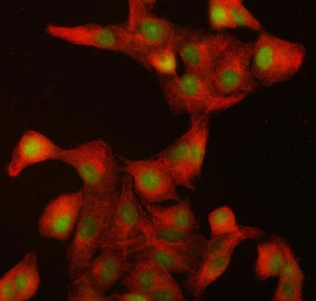 Immunofluorescent staining of FFPE human A549 cells with ILKAP antibody (green) and Beta Tubulin mAb