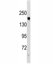 TSC1 antibody western blot analysis in mouse liver tissue lysate. Expected/observed molecular weight