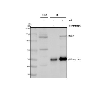 Immunoprecipitating TAOK1 in Hela whole cell lysate. Western blot analysis of TAOK1 using anti-TAOK1
