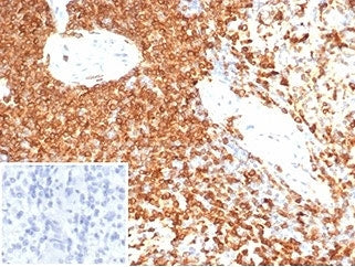 IHC staining of FFPE human spleen tissue with CD74 antibody (clone CLIP/7193) at 2ug/ml. Negative co