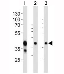EpCAM Antibody
