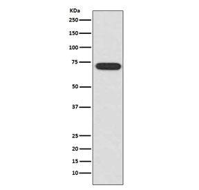 Western blot testing of human HeLa cell lysate with ATF2 antibody. Expected molecular weight: 65-70 