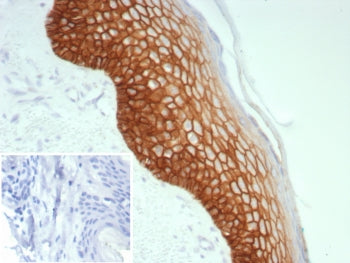 Desmoglein 3 Antibody / DSG3