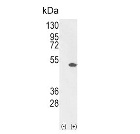 Western blot testing of 1) non-transfected and 2) transfected 293 cell lysate with PEA3 antibody.