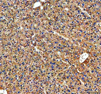 IHC staining of FFPE mouse liver tissue with Transferrin antibody. HIER: boil tissue sections in pH8