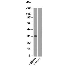 Uroplakin 3A Antibody / UPK3A
