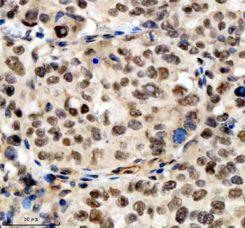 Immunohistochemical staining of SCAF11 using anti-SCAF11 antibody. SCAF11 was detected in a paraffin