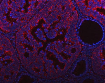NDUFAF4 Antibody / HRPAP20 / C6orf66
