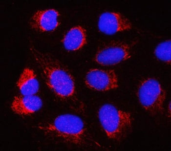PSMB2 Antibody / Proteasome subunit beta type 2