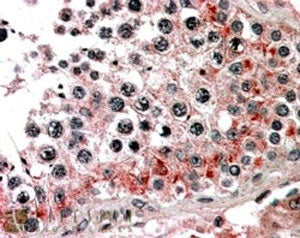 IHC testing of FFPE human testis with ABCB9 antibody at 4ug/ml. HIER: steamed with pH6 citrate buffe