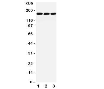 Western blot testing of LRP5 antibody and Lane 1: rat liver; 2: mouse liver; 3: (m) NIH3T3 lysate. P