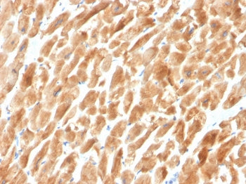 IHC staining of FFPE cardiac muscle with Dystrophin antibody (clone DMD/3242). HIER: boil tissue sec