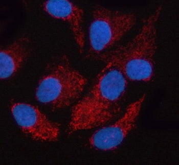 OXCT2 Antibody / SCOT-t