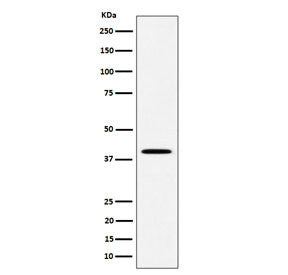 Western blot testing of human JAR cell lysate with DLX3 antibody. Predicted molecular weight ~32 kDa