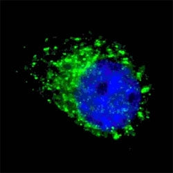 LC3A Antibody / MAP1LC3A, 0.08ml