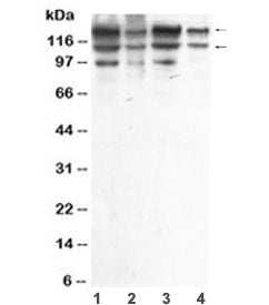 ADAR1 Antibody