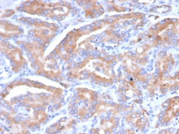 IHC staining of FFPE human prostate tissue with SI-CLP antibody (clone CHID1/6368) HIER: boil tissue