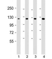 Western blot testing of 1) human DU-145, 2) human HepG2, 3) mouse brain and 4) HeLa cell lysate with AIP1 antibody at 1:1000. Predicted molecular weight: 132 kDa.