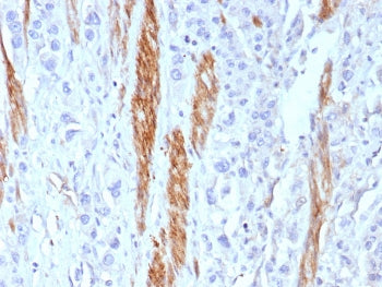 IHC staining of FFPE human colon tissue with NCAM antibody (clone rNCAM1/8580). HIER: boil tissue se