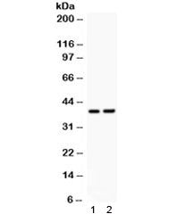 Western blot testing of 1) rat brain and 2 mouse NIH3T3 lysate with SOX1 antibody. Predicted/observe