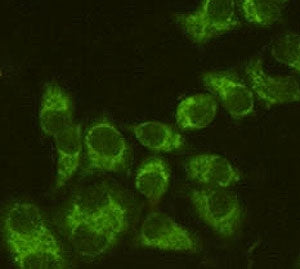 Immunofluorescent staining of permeabilized human HeLa cells with Fascin antibody (clone FAN55-1, gr