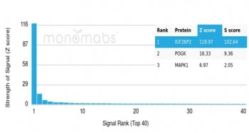 Analysis of a HuProt(TM) microarray containing more than 19,000 full-length human proteins using IGF