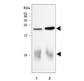 Cardiac Phospholamban Antibody / PLN / PLB
