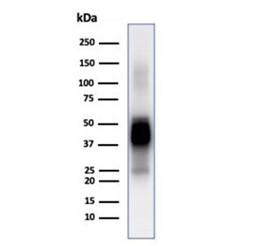 Western blot testing of human brain tissue lysate using GFAP antibody (clone GFAP/6884). Predicted m