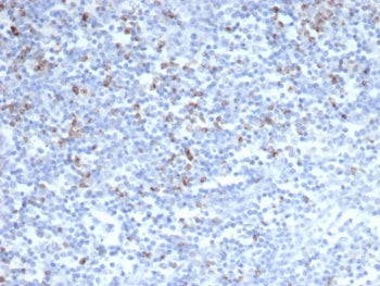 IHC staining of FFPE human tonsil tissue with CTLA4 antibody (clone CTLA4/6864R). HIER: boil tissue 