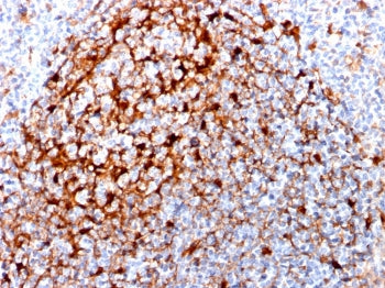 IHC staining of FFPE human tonsil with Cystatin A antibody (clone CPTC-CSTA-1). HIER: boil tissue se