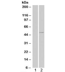 Western blot of HEK293 lysate overexpressing human CSNK1E tested with CSNK1E antibody [mock transfec