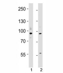 Western blot testing of UHRF1 antibody at 1:4000 dilution; Lane 1: KG-1 lysate, 2: MCF-7 lysate; Pre