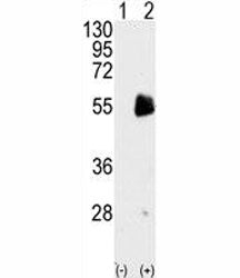 Western blot analysis of PRMT7 antibody and 293 cell lysate either nontransfected (Lane 1) or transi