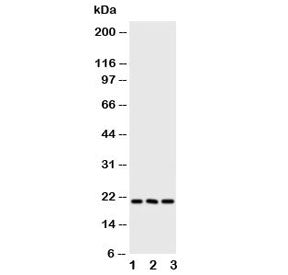 Western blot testing of FGF21 antibody and Lane 1: human A549; 2: human A431; 3: mouse HEPA cell lys