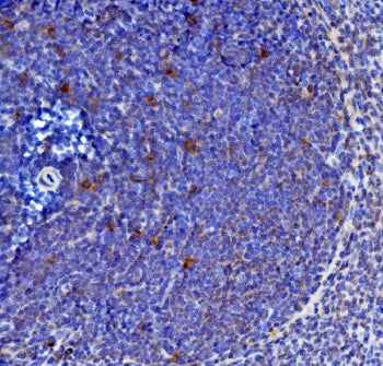 IHC staining of FFPE rat spleen with Il-21 antibody. HIER: boil tissue sections in pH8 EDTA for 20 m