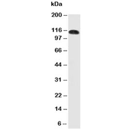 Western blot testing of CEACAM5 antibody and human SW620 cell lysate. Expected molecular weight: 80~