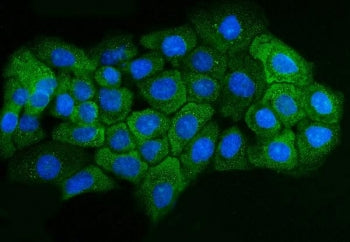 Immunofluorescent staining of FFPE human A431 cells with Adenosine Receptor A2b antibody (green) and