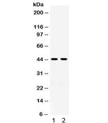 Western blot testing of 1) rat kidney and 2) human placenta lysate with HSD11B2 antibody. Expected/o