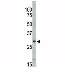 Western blot analysis of SIRT5 antibody in Jurkat lysate