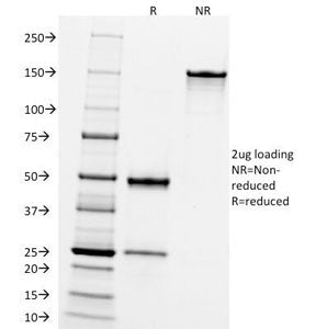 CD10 Antibody / Neprilysin