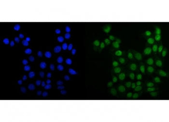 Immunofluorescent staining of FFPE human MCF7 cells with MCM6 antibody (green) and DAPI nuclear stai