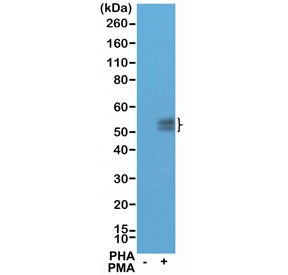 Western blot testing of lysate from Jurkat cells, untreated (-) or treated (+) with PHA and PMA, wit