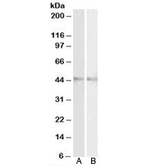 Western blot testing of mouse [A] and rat [B] eye lysates with RNF13 antibody at 2ug/ml. Predicted m