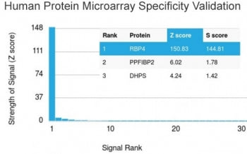 Analysis of HuProt(TM) microarray containing more than 19,000 full-length human proteins using RBP4 