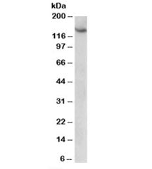 Western blot testing of HeLa lysate with AGTPBP1 antibody at 1ug/ml. Predicted molecular weight: ~13