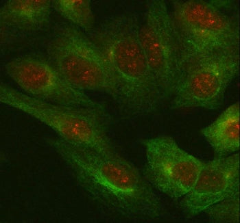 Immunofluorescent staining of FFPE human A549 cells with IL-18 antibody (red) and Beta Tubulin mAb (