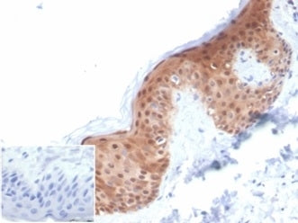 SERPINB5 Antibody / MASPIN